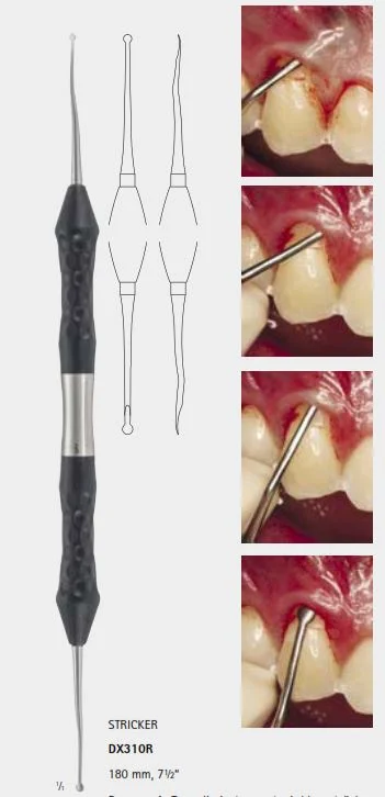 Зонд стоматологический тунельный, длина 180 мм, арт: DX310R