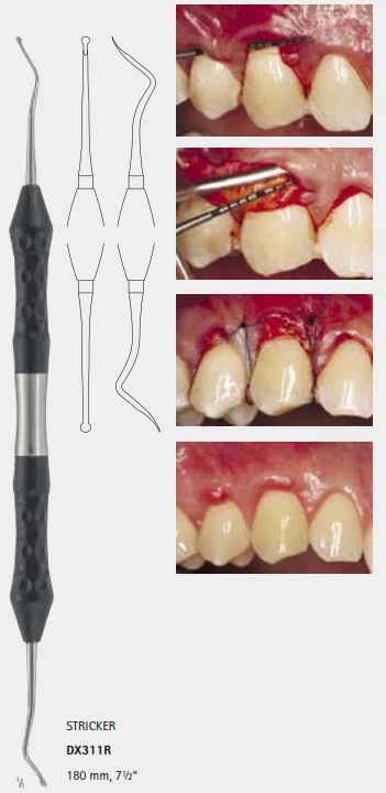 Зонд стоматологический тунельный, длина 180 мм, арт: DX311R